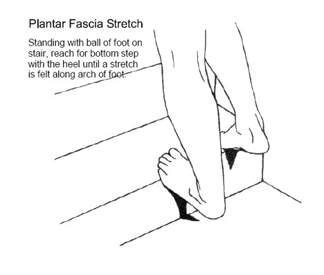 Effective Plantar Fasciitis Treatment