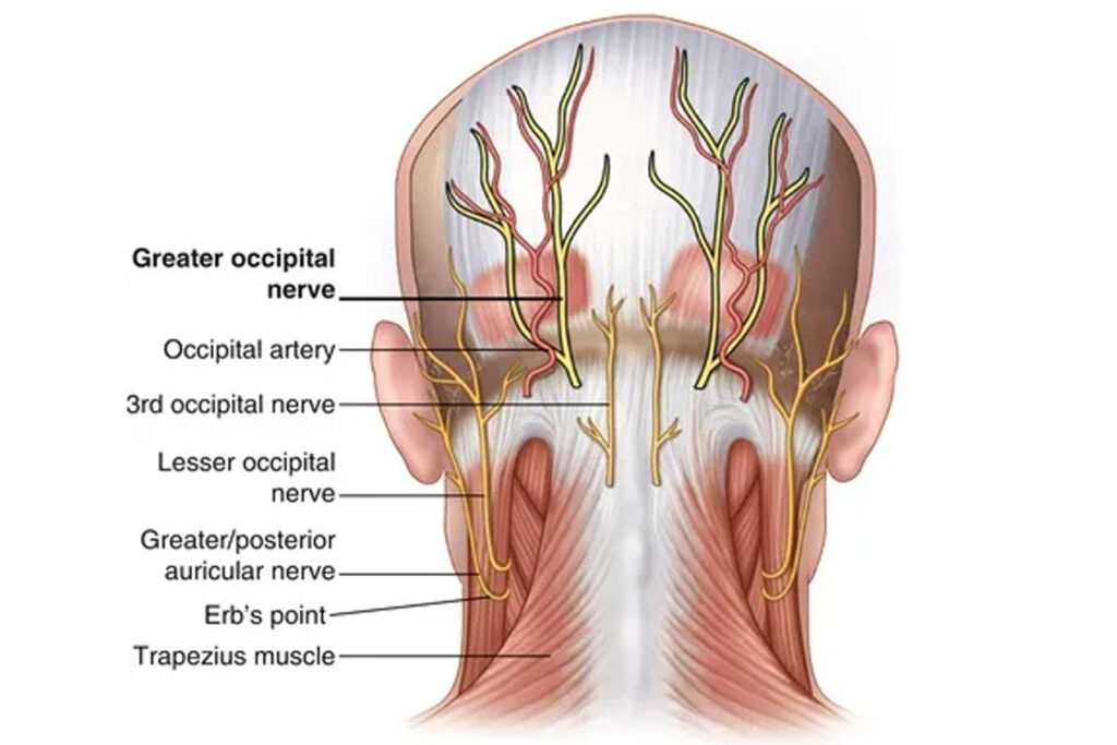 Occiput Headache Nerves